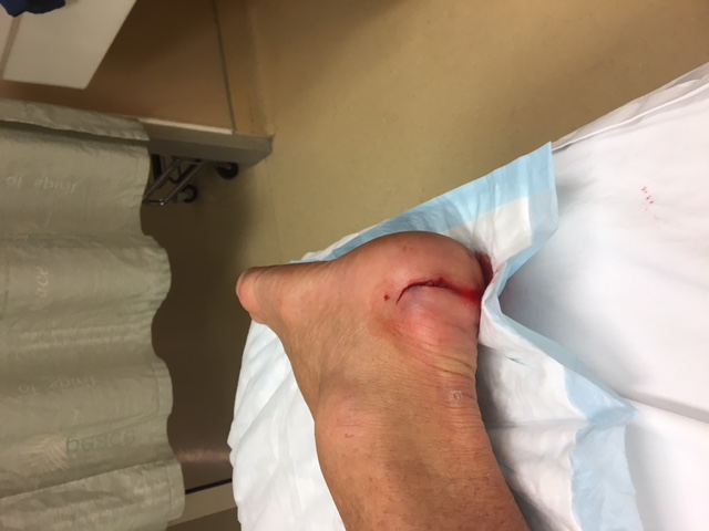 Name:  heal laceration.JPG
Views: 1179
Size:  67.2 KB