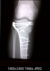 Click image for larger version. 

Name:	side view of x ray.jpg 
Views:	168 
Size:	765.9 KB 
ID:	109514